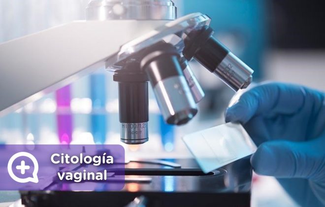 Citología vaginal, test de papanicolauo. ginecología. MediQuo, tu amigo médico. Chat médico.