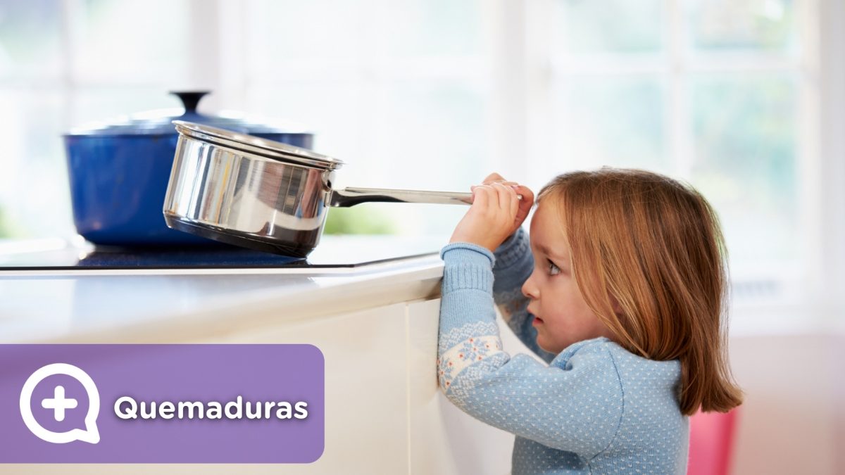 Quemaduras leves en niños y adultos por accidentes domésticos en la cocina