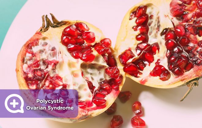 Polycystic ovarian syndrome, women, irregular menstruation, cysts, ovaries, polycystic,