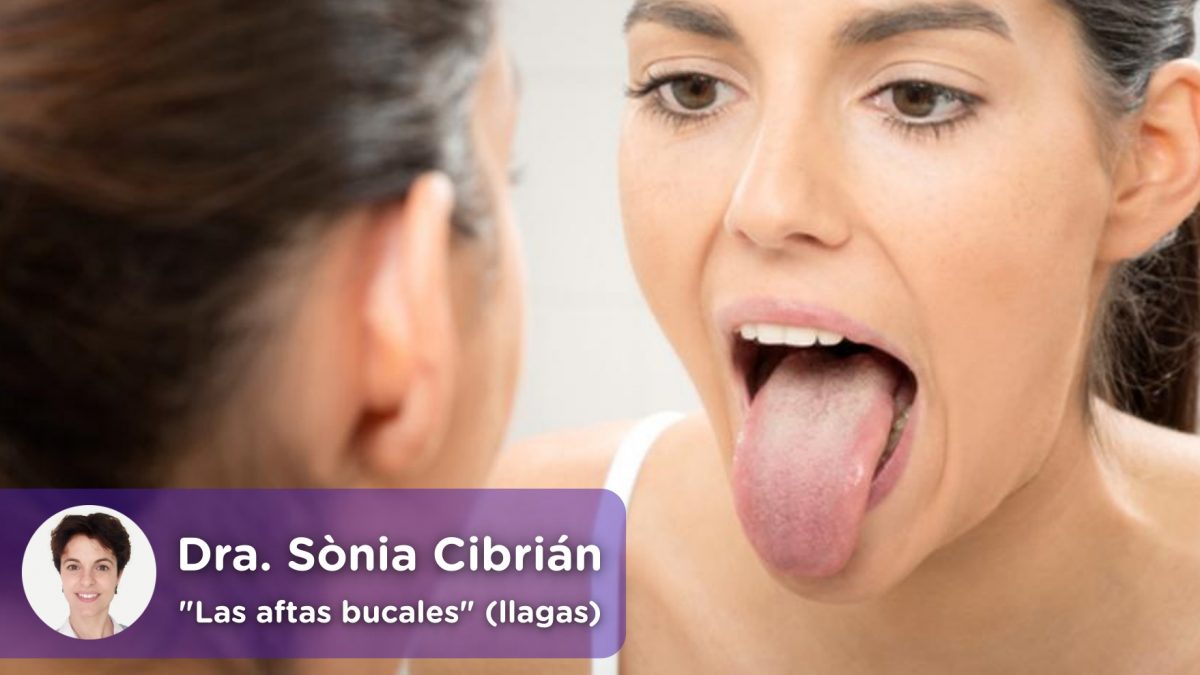 Mujer mirando en el espejo su lengua con llagas o aftas bucales