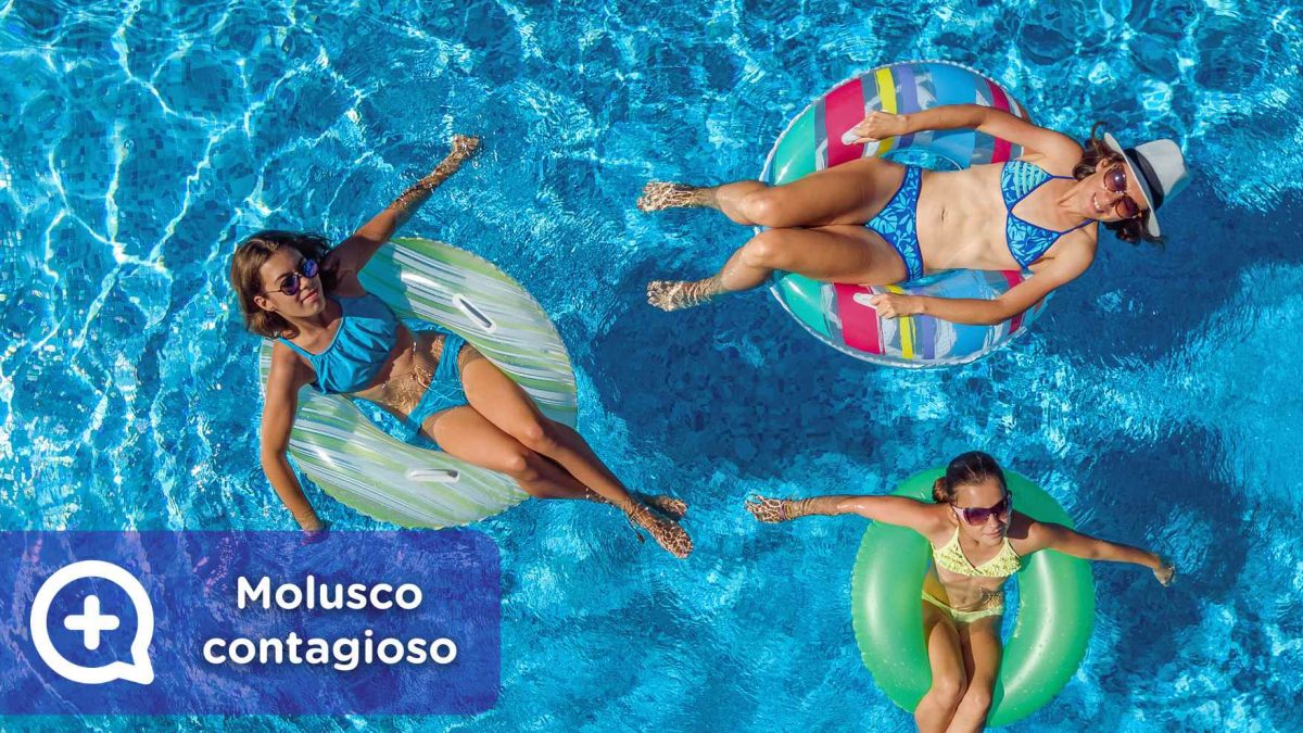 Molusco contagioso en la piscina, verano, contacto, toalla, infección cutánea.