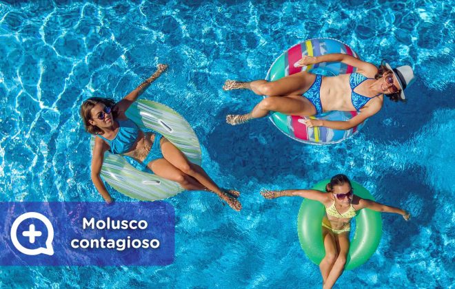 Molusco contagioso en la piscina, verano, contacto, toalla, infección cutánea.