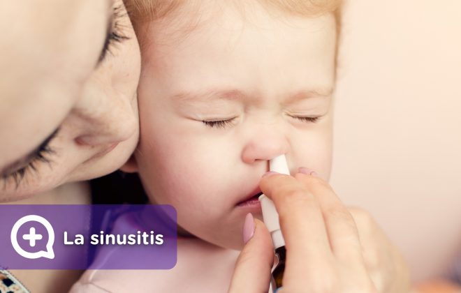 La sinusitis en adultos y niños, cómo tratarla, qué medicación se puede tomar