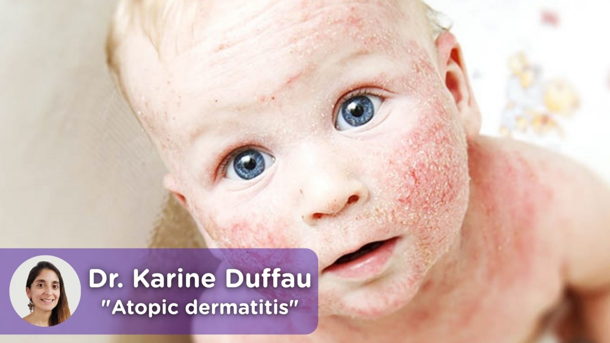 Child atopic dermatitis. MediQuo, your doctor friend. Medical chat Dr. Karine Duffau.