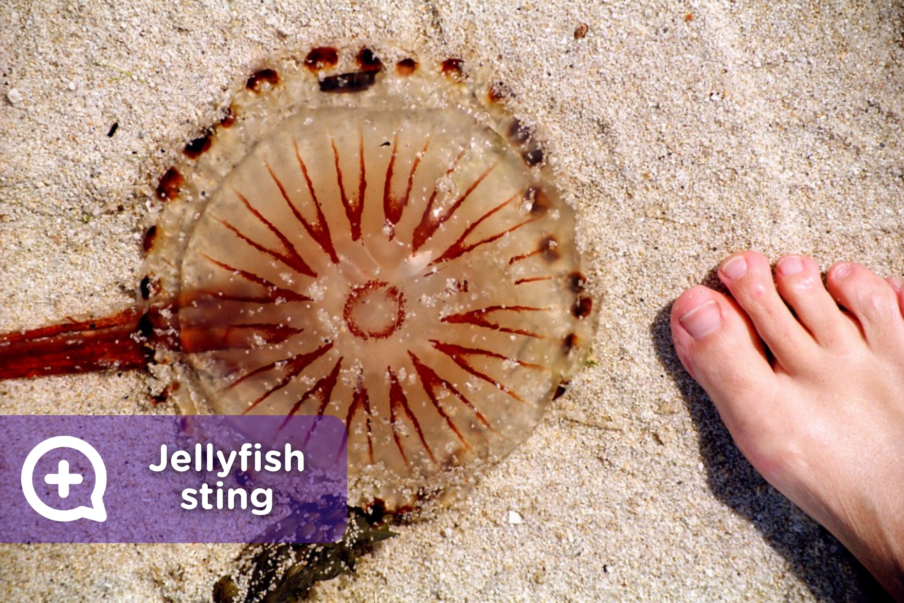 Jellyfish Stingers In Skin