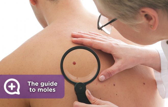 Moles, the definitive guide to recognize them, control them and treat them.