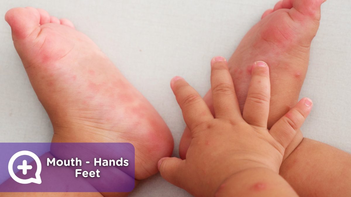 The hand mouth and foot disease is very contagious