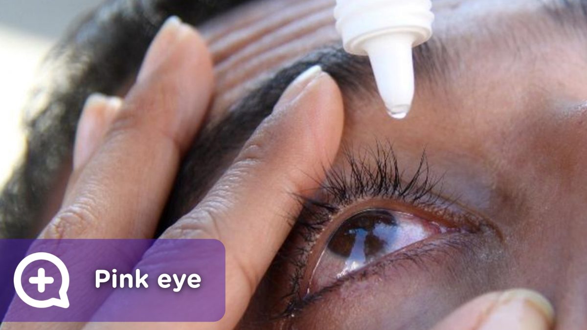 Conjunctivitis, contagious eye infection, drops to relieve itching