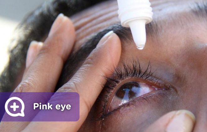 Conjunctivitis, contagious eye infection, drops to relieve itching