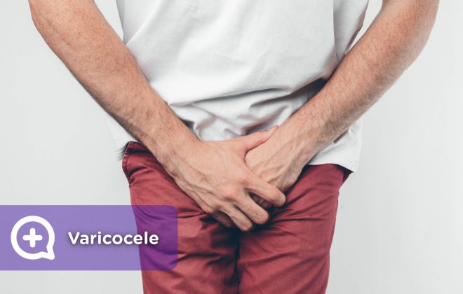 The varicocele is a spermatic cord that is around the testicles, composed of arteries, veins and nerves, which carries blood to the testicles, as well as semen to the vas deferens.