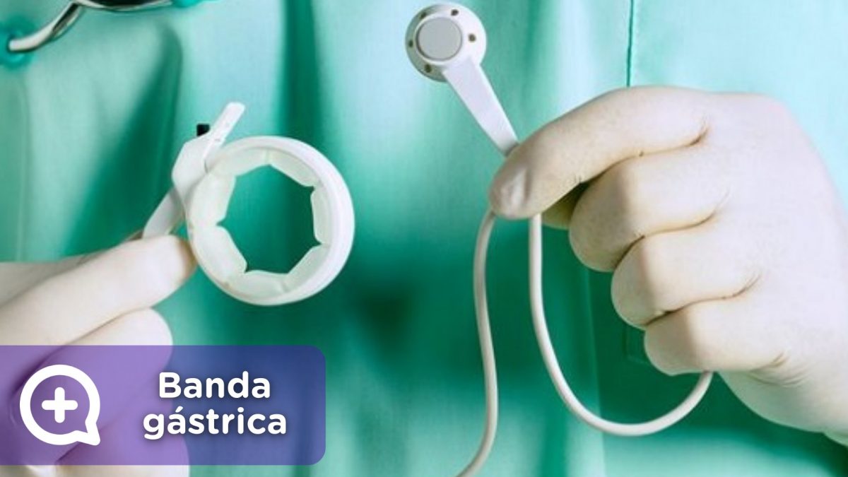 Banda gástrica, operación pérdida de peso. redución de estómago. MediQuo, tu amigo médico. Chat médico.