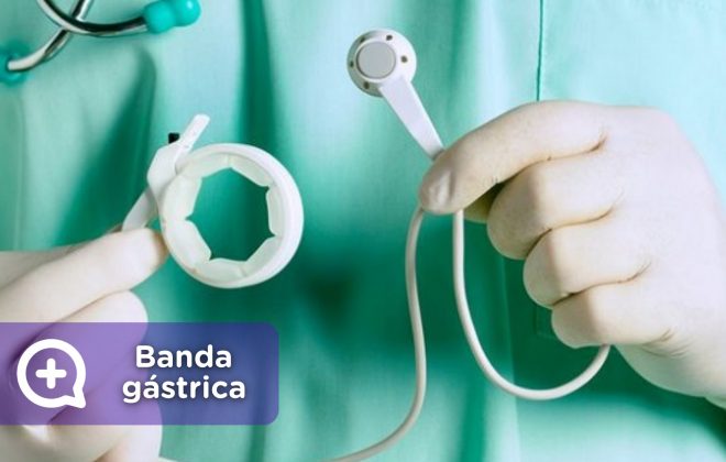 Banda gástrica, operación pérdida de peso. redución de estómago. MediQuo, tu amigo médico. Chat médico.