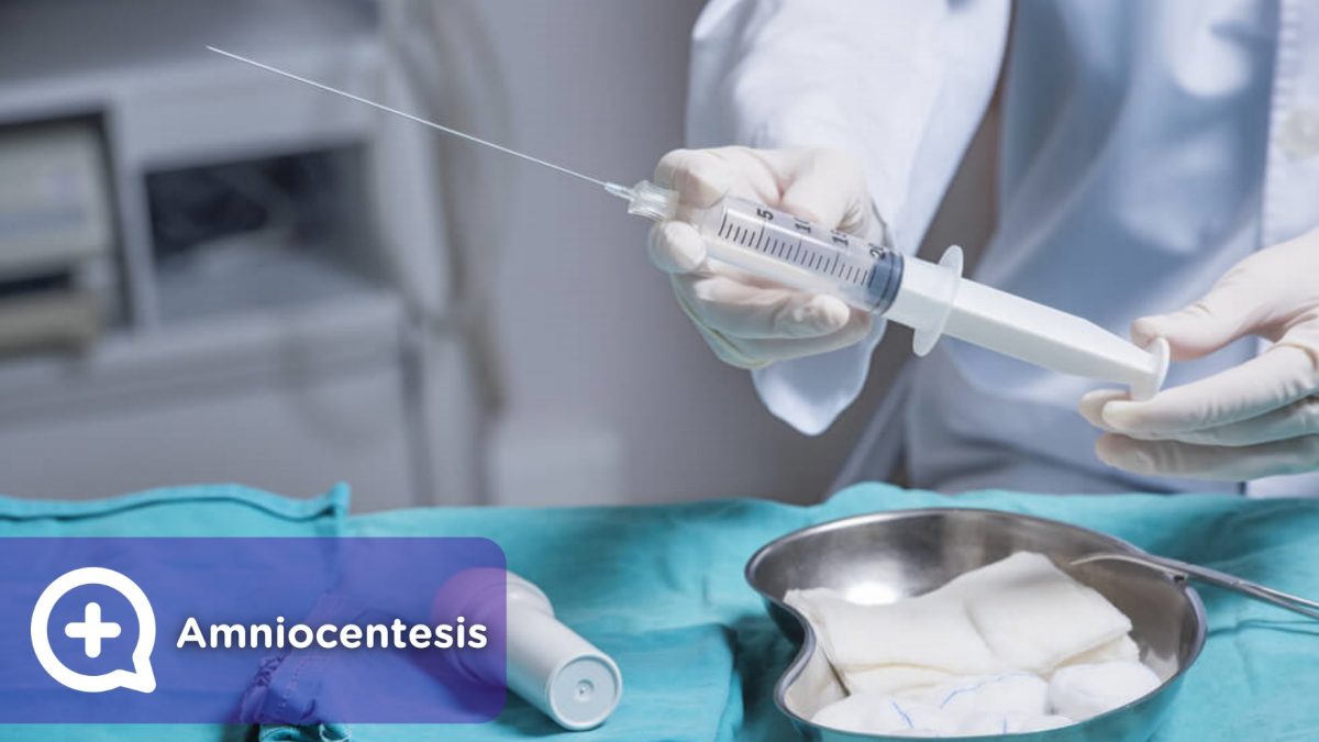 Amniocentesis, prueba de embarazo, punción. Mediquo, tu amigo médico. Chat médico. Ginecología