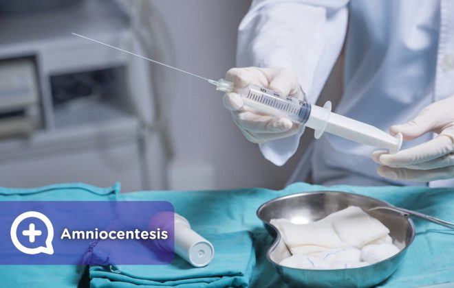 Amniocentesis, prueba de embarazo, punción. Mediquo, tu amigo médico. Chat médico. Ginecología