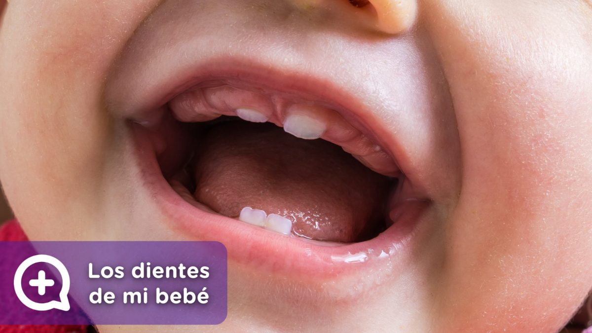 Los primeros dientes de mi bebé, dolor, fiebre, molestias. MediQuo, tu amigo médico. Chat médico. Pediatría