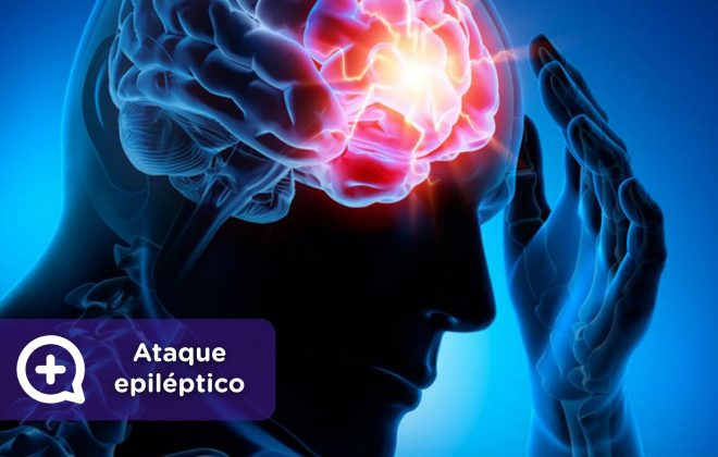 ataque epiléptico, como actuar ante un ataque de epilepsia. MediQuo, tu amigo médico, chat médico.