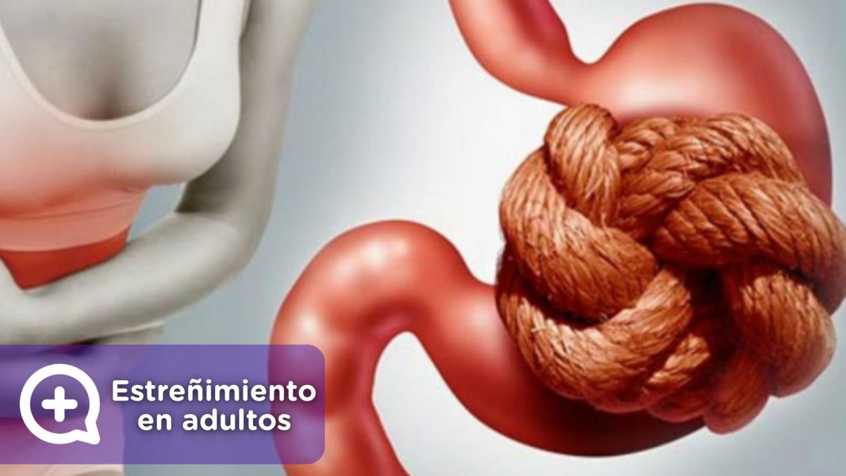 La lista de alimentos que debes y no comer para evitar el estreñimiento. MediQuo, tu amigo médico. Chat médico.