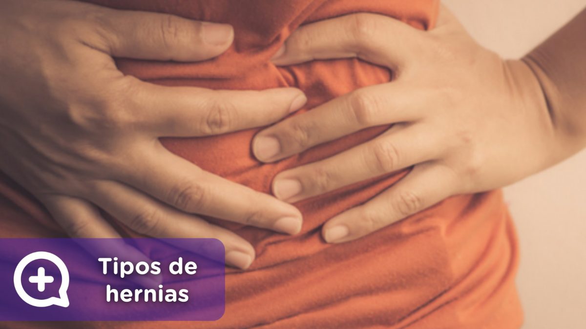 Tipos de hernias. MediQuo, tu amigo médico. Chat médico.