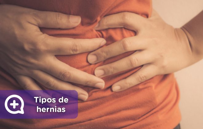 Tipos de hernias. MediQuo, tu amigo médico. Chat médico.