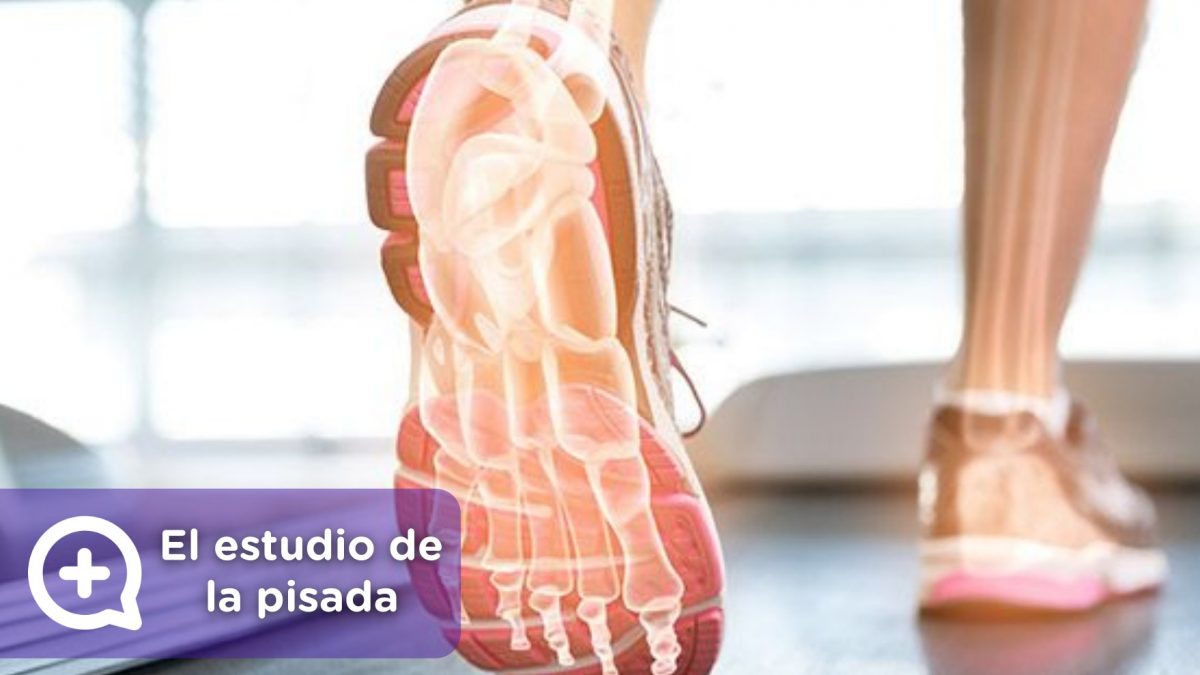 Estudio de la pisada, dolor de espalda, pies. Deporte. MediQuo, Tu amigo médico. Chat médico.