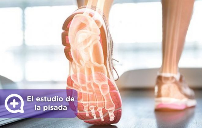 Estudio de la pisada, dolor de espalda, pies. Deporte. MediQuo, Tu amigo médico. Chat médico.