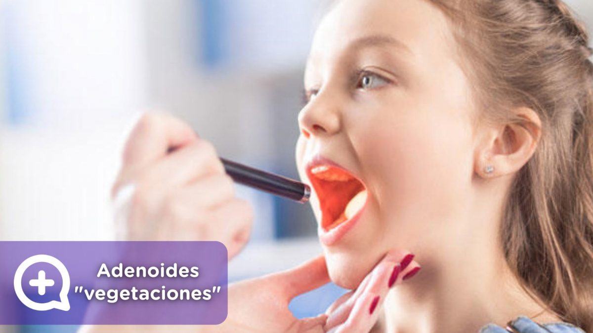 Adenoides, vegetaciones o carnots. Niños, pediatría. MediQuo. Tu amigo médico. Chat médico.