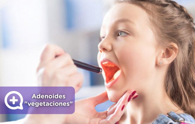 Adenoides, vegetaciones o carnots. Niños, pediatría. MediQuo. Tu amigo médico. Chat médico.