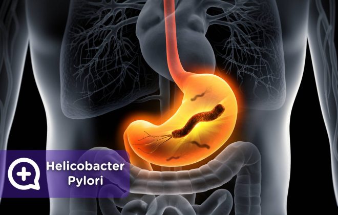 Helicobacter Pylori. Mediquo, tu amigo médico. Chat médico.