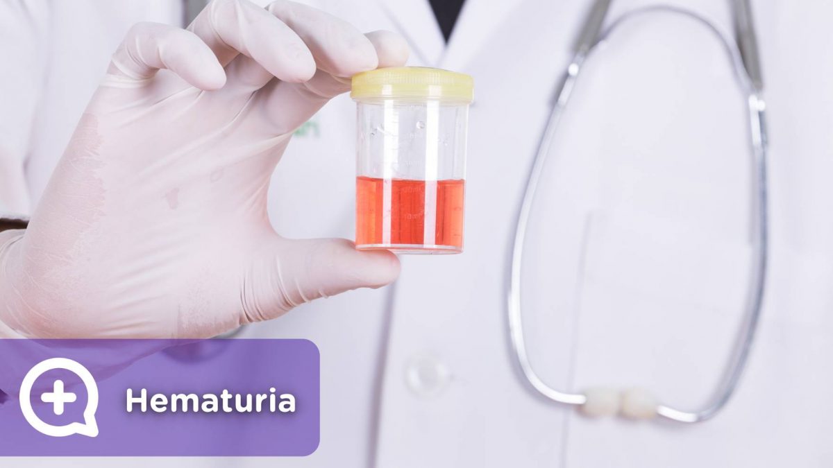 Sangre en la orina. Hematuria. Mediquo, Tu amigo médico, Chat médico.