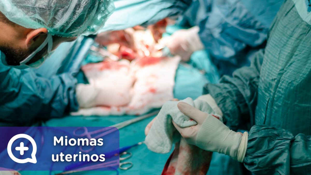 Miomas uterinos, benigno. Útero. Ginecología. Mediquo, Tu amigo médico.