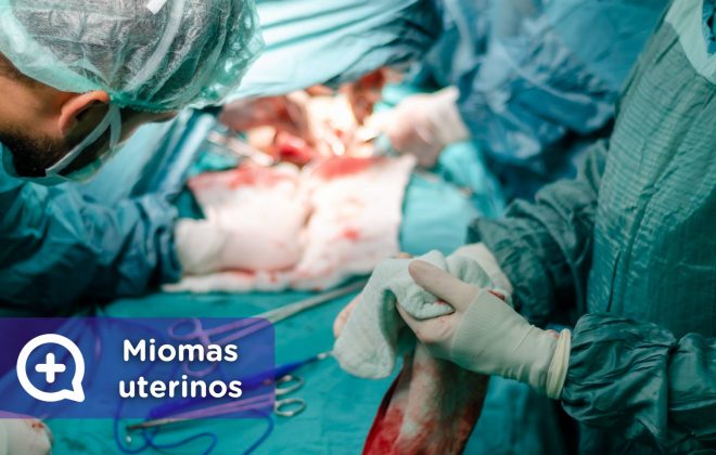 Miomas uterinos, benigno. Útero. Ginecología. Mediquo, Tu amigo médico.