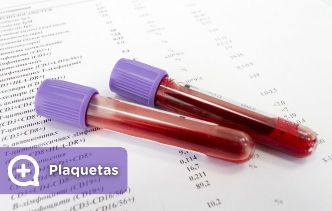 Análisis de sangre, plaquetas altas, plaquetas bajas, qué significa. Mediquo, tu amigo médico. Chat médico.