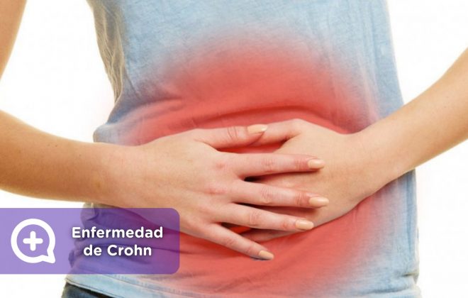 Enfermedad de crohn, aparato digestivo. Mediquo, Tu amigo médico. Chat médico. Salud.