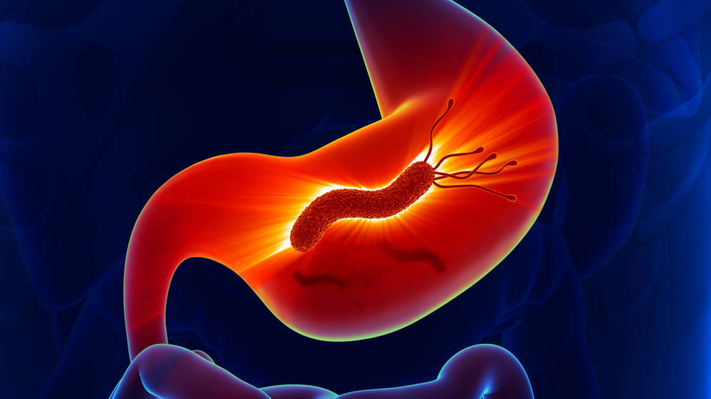 Las causas de la gastritis mediQuo