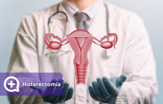 Histerectomía, salud femenina, deseo sexual, ginecología, mujer. Mediquo, tu amigo médico, chat médico.