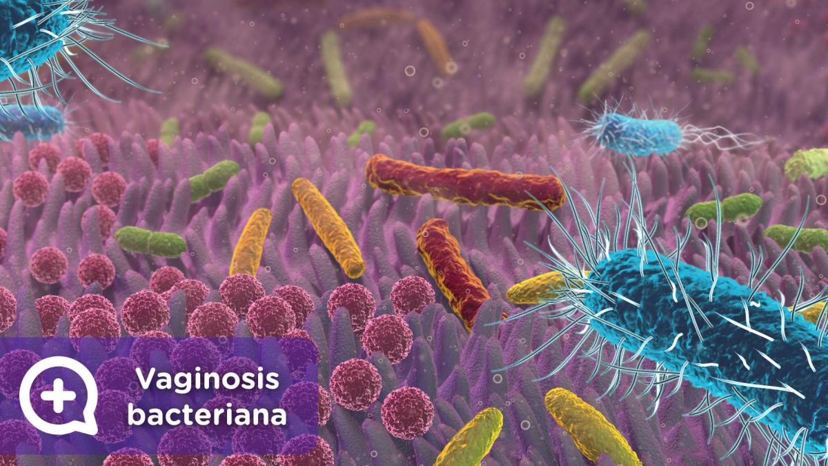 vaginosis bacteriana, infección. salud mujer, ginecología. mediquo, tu amigo médico. Chat médico.