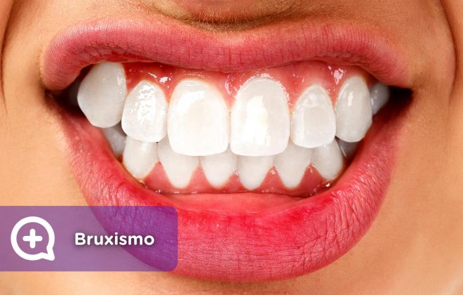 Bruxismo, desgaste dental. Mediquo, Salud bucal. Tu amigo médico. Chat.