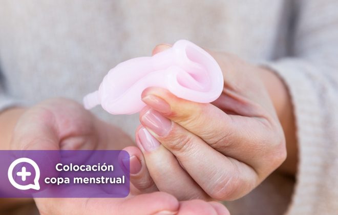 Colocación copa menstrual. Ginecología, DIU. Mediquo, Tu amigo médico. Chat médico.