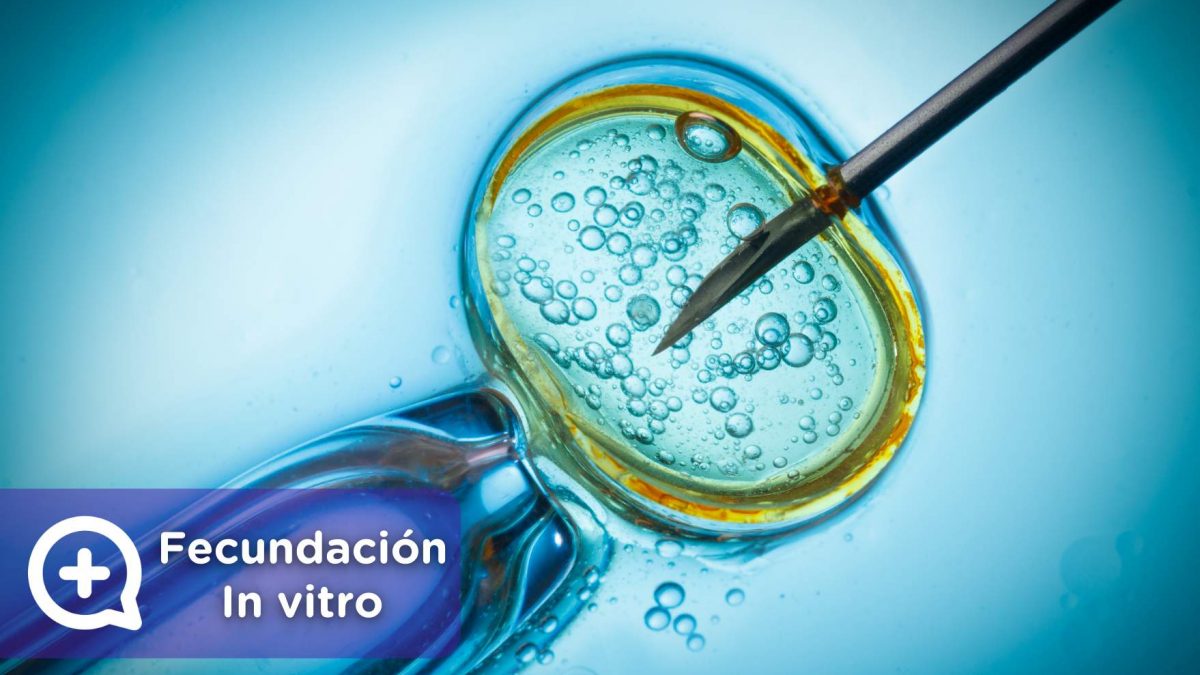 fecundación in vitro, embarazo, espermatozoide, óvulo. Mediquo, ginecología. fertilización. Mediquo.