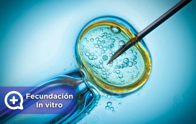 fecundación in vitro, embarazo, espermatozoide, óvulo. Mediquo, ginecología. fertilización. Mediquo.