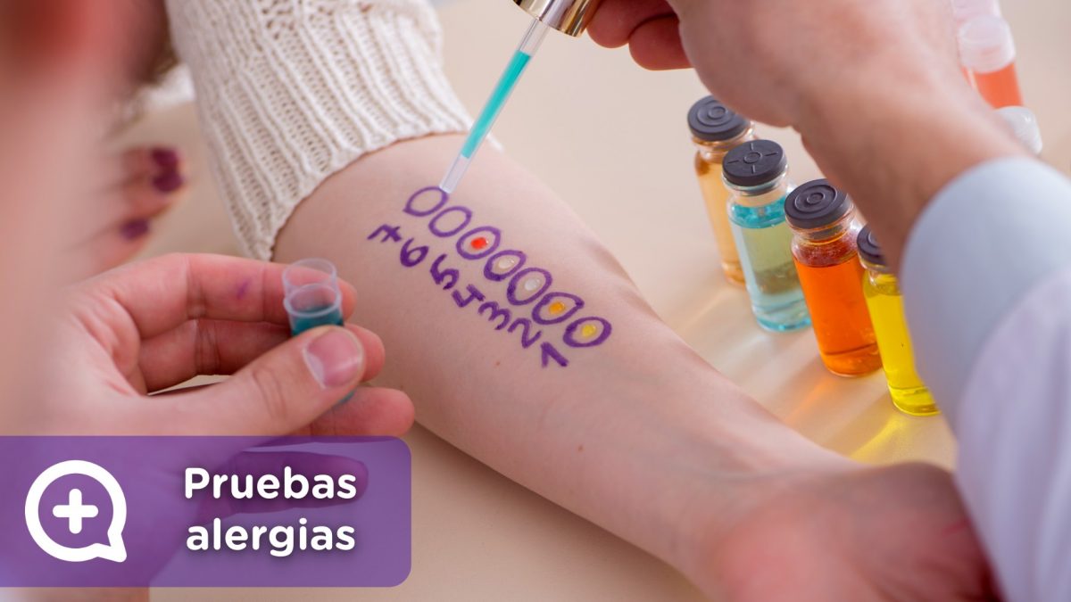 Pruebas cutáneas alergia. Brazo, pick test. Mediquo, Tu amigo médico. Chat médico. Ácaros, polen