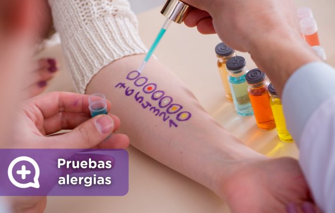 Pruebas cutáneas alergia. Brazo, pick test. Mediquo, Tu amigo médico. Chat médico. Ácaros, polen