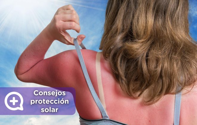 protección solar, consejos, vitamina D. Mediquo, Tu amigo médico. Chat médico.