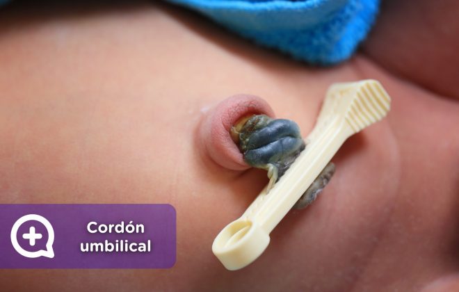 Cuidados del cordón umbilical. Pediatría. Bebé. Mediquo. Tu amigo médico. Chat médico. Salud.