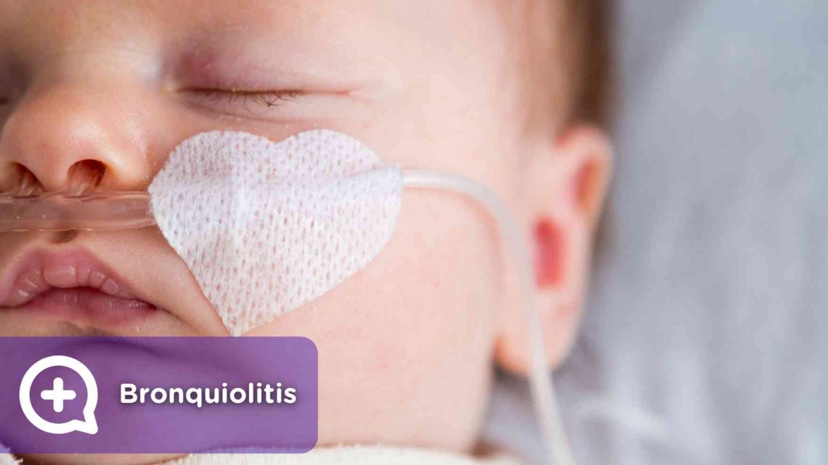 Bronquiolitis, virus, infección, vías respiratorias, pediatría, médicos, mediquo. Salud