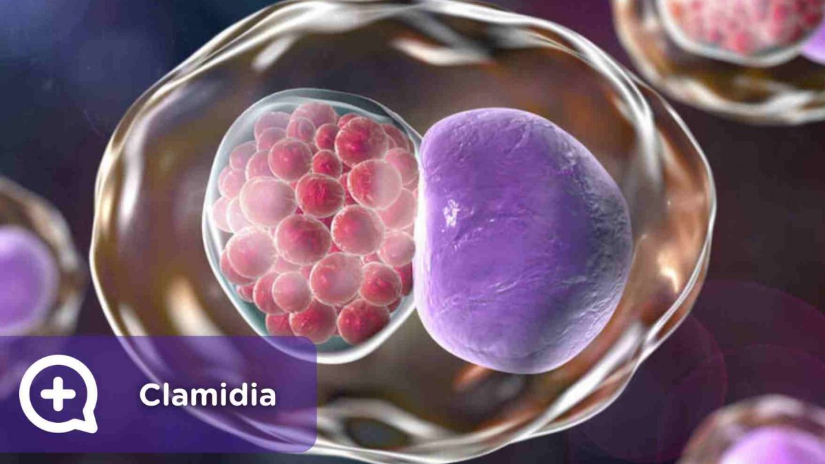 Clamidia, enfermedad de transmisión sexual. ETS. Mediquo. Bacteria. Infección. Salud.