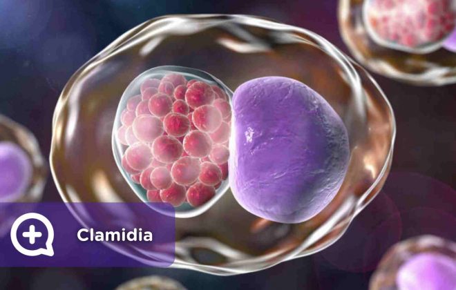 Clamidia, enfermedad de transmisión sexual. ETS. Mediquo. Bacteria. Infección. Salud.