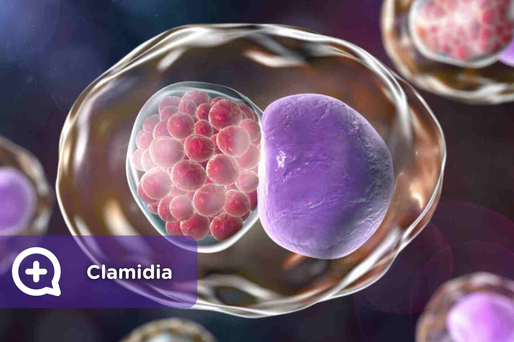 sintomas+de+clamidia+en+ojos