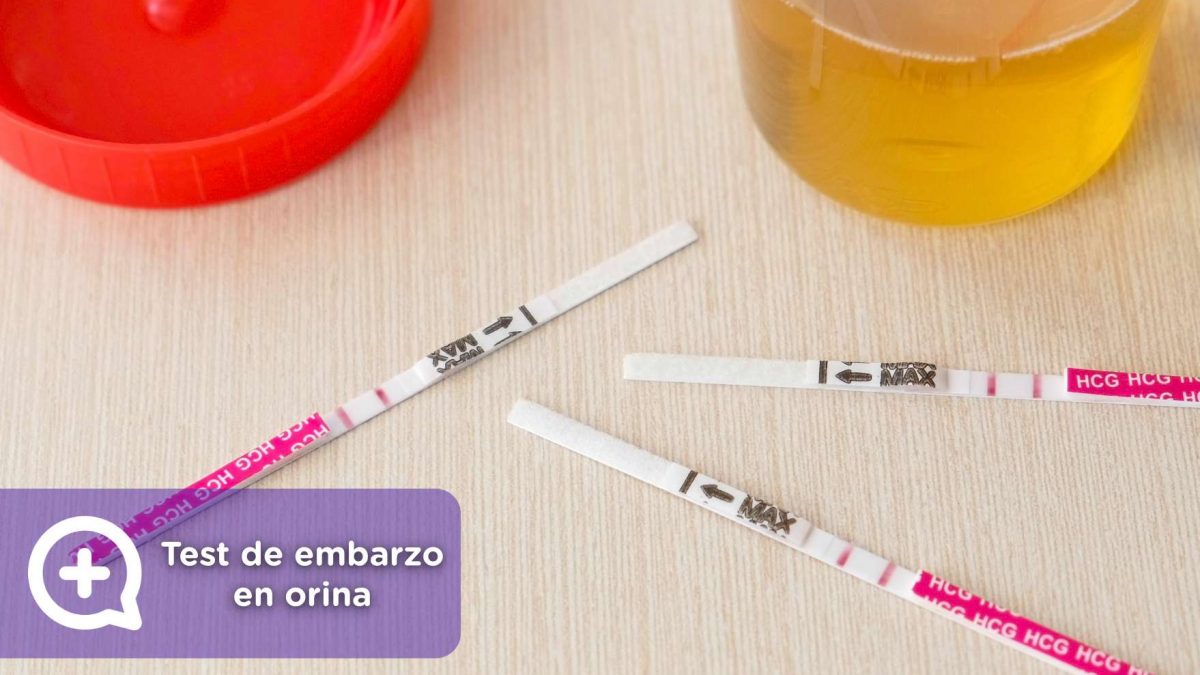 qué es el test de embarazo en orina y cómo se hace. ginecología, mediquo