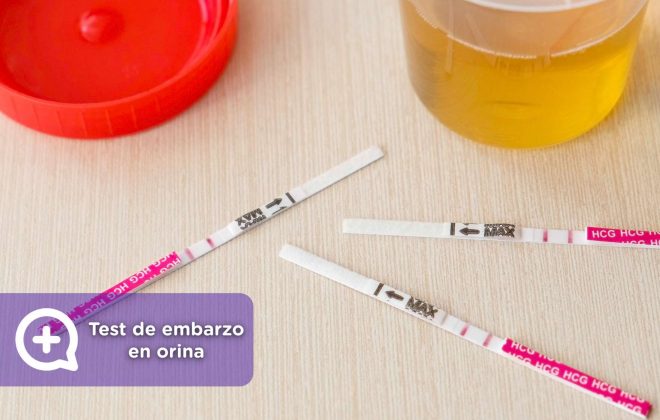 qué es el test de embarazo en orina y cómo se hace. ginecología, mediquo